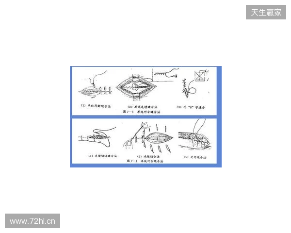 广州豹官方:杨浩眉弓伤口缝合30余针,预计5-7天后拆线 广州豹官方:杨浩眉弓伤口缝合30余针,预计5-7天后拆线
